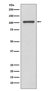 INPP4B/Type Ii 4 Phosphatase Rabbit Monoclonal Antibody