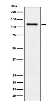 LI-Cadherin-17 CDH17-/LI Rabbit Monoclonal Antibody