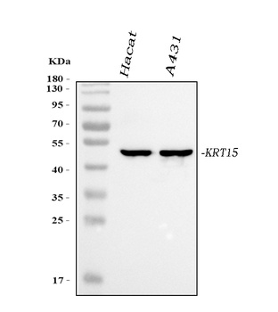 Cytokeratin 15 Rabbit Monoclonal Antibody