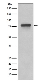 5T4 TPBG Rabbit Monoclonal Antibody