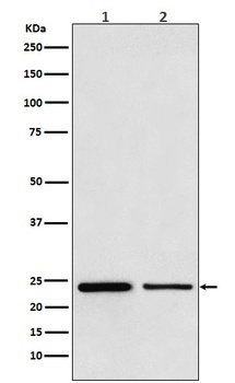 TBPL1 Rabbit Monoclonal Antibody