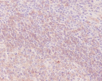 Human IgM IGHM Rabbit Monoclonal Antibody
