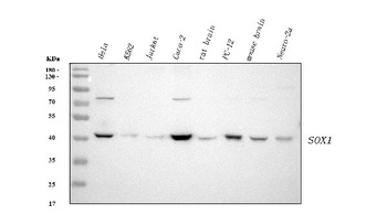 SOX1 Rabbit Monoclonal Antibody