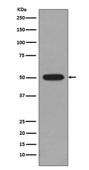 Tubulin beta 4B/2A/2B Rabbit Monoclonal Antibody