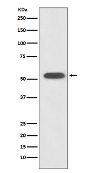 HSPA14 Rabbit Monoclonal Antibody