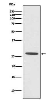 CDCA3 Rabbit Monoclonal Antibody