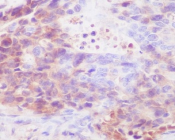 IgG4 IGHG4 Rabbit Monoclonal Antibody
