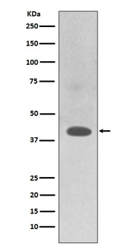 TRAM2 Rabbit Monoclonal Antibody