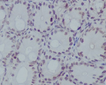 Histone H3 HIST1H3A Rabbit Monoclonal Antibody