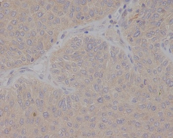 GCET2 Rabbit Monoclonal Antibody