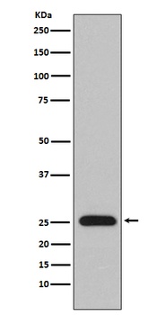 Lambda Light chain IGLV1-51/IGLV1 Rabbit Monoclonal Antibody