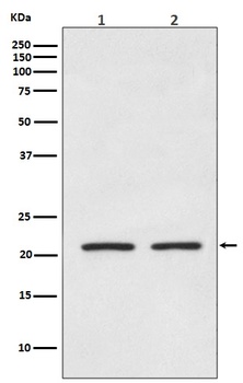 AKAP14 Rabbit Monoclonal Antibody
