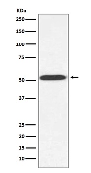 alpha Tubulin TUB1 Rabbit Monoclonal Antibody
