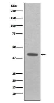 EpCAM/Trop1 Rabbit Monoclonal Antibody