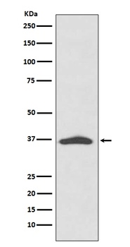 EpCAM/Trop1 Rabbit Monoclonal Antibody