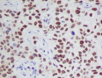 Phospho-JAK2/JAK2 Rabbit Monoclonal Antibody
