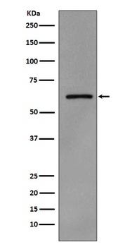 Phospho-Src Rabbit Monoclonal Antibody