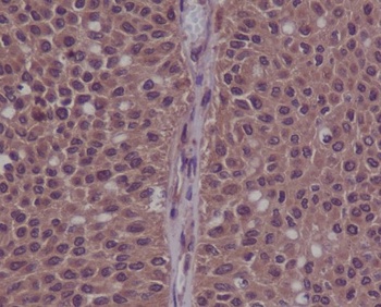 Phospho-CDK2/CDK2 Rabbit Monoclonal Antibody