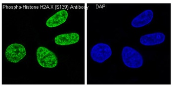 Phospho-Histone H2A.X H2AFX/H2A Rabbit Monoclonal Antibody