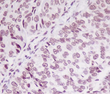 Phospho-SMC1/SMC1 Rabbit Monoclonal Antibody