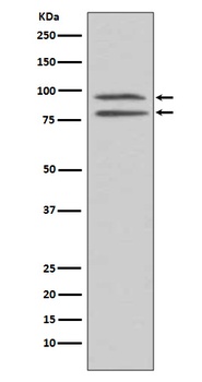 Phospho-MSK1 RPS6KA5/MSK1 Rabbit Monoclonal Antibody