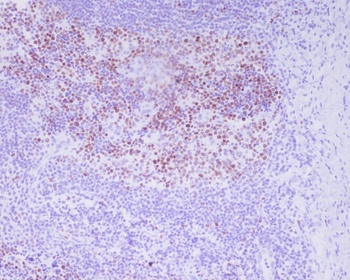 Phospho-Histone H3 H3F3A Rabbit Monoclonal Antibody