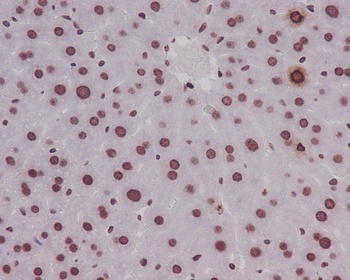 Phospho-Histone H3 HIST1H3A Rabbit Monoclonal Antibody