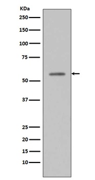 Phospho-p53 TP53 Rabbit Monoclonal Antibody