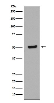 Phospho-p53 TP53 Rabbit Monoclonal Antibody
