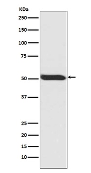 Phospho-p53 TP53 Rabbit Monoclonal Antibody