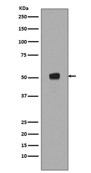 Phospho-p53 TP53 Rabbit Monoclonal Antibody