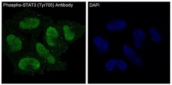 Phospho-STAT3/STAT3 Rabbit Monoclonal Antibody