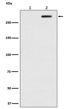 Phospho-ATM/ATM Rabbit Monoclonal Antibody
