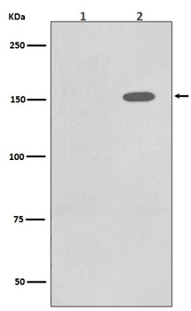 Phospho-EGFR/EGFR Rabbit Monoclonal Antibody
