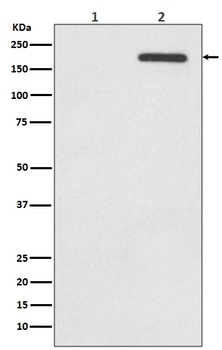 Phospho-EGFR/EGFR Rabbit Monoclonal Antibody