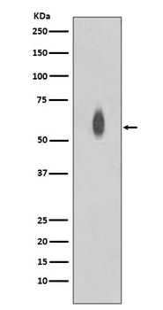 Phospho-c-Myc Rabbit Monoclonal Antibody
