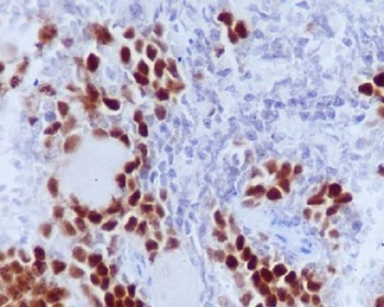 Phospho-Rb RB1 Rabbit Monoclonal Antibody