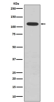 Phospho-Rb RB1 Rabbit Monoclonal Antibody