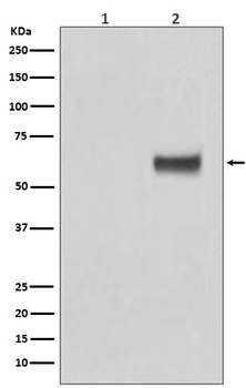 Phospho-ER alpha ESR1/ER Rabbit Monoclonal Antibody