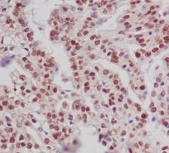 Phospho-ER alpha ESR1/ER Rabbit Monoclonal Antibody