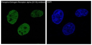 Phospho-ER alpha ESR1/ER Rabbit Monoclonal Antibody