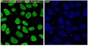 Phospho-Smad3 Rabbit Monoclonal Antibody
