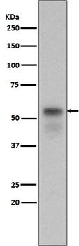 Phospho-Smad3 Rabbit Monoclonal Antibody