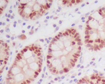 Phospho-Nrf2 NFE2L2 Rabbit Monoclonal Antibody