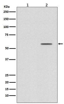 Phospho-Smad2 Rabbit Monoclonal Antibody
