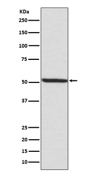 Phospho-IRF3/IRF3 Rabbit Monoclonal Antibody
