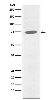 Phospho-BTK/BTK Rabbit Monoclonal Antibody