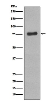 Phospho-BTK/BTK Rabbit Monoclonal Antibody