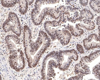 Phospho-DNA PKcs PRKDC/DNA Rabbit Monoclonal Antibody