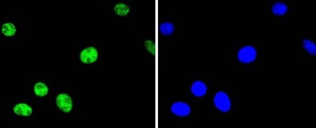 Phospho-ATF2/ATF2 Rabbit Monoclonal Antibody
